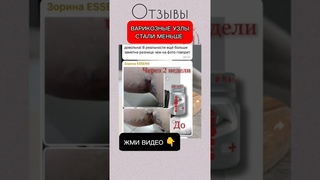 От варикоза, отеков, ночных судорог и геморроя. Flow‘EN Essens
