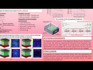 E. Bryanskaya . Simulation of digital diaphanoscopy signal changes...
