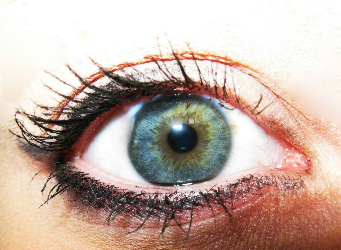 Иван Ширшиблев | Киров