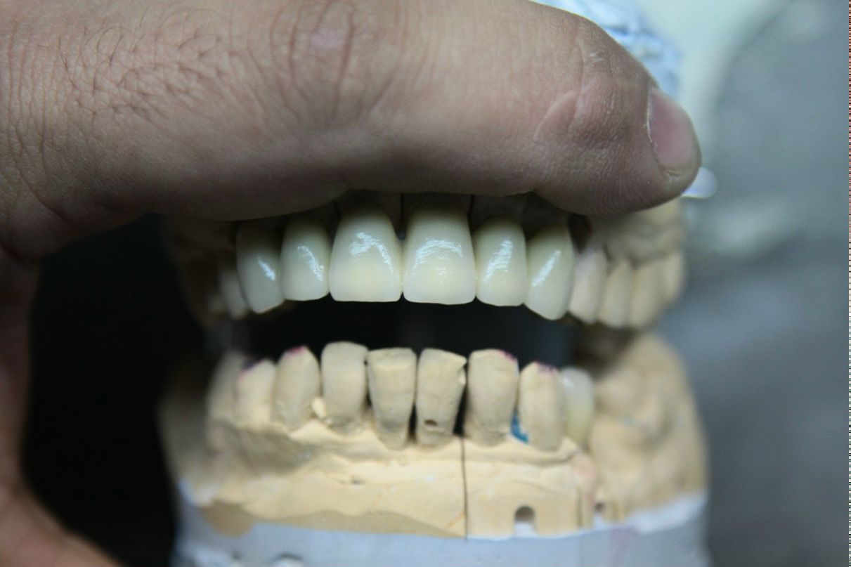 Эрнест Абрамян | Москва