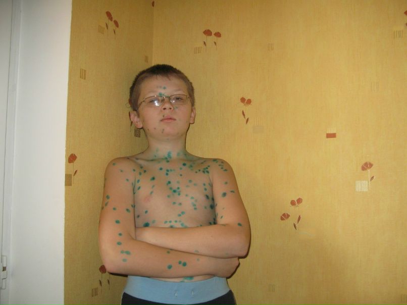 Антон Антипов ???? | Киев